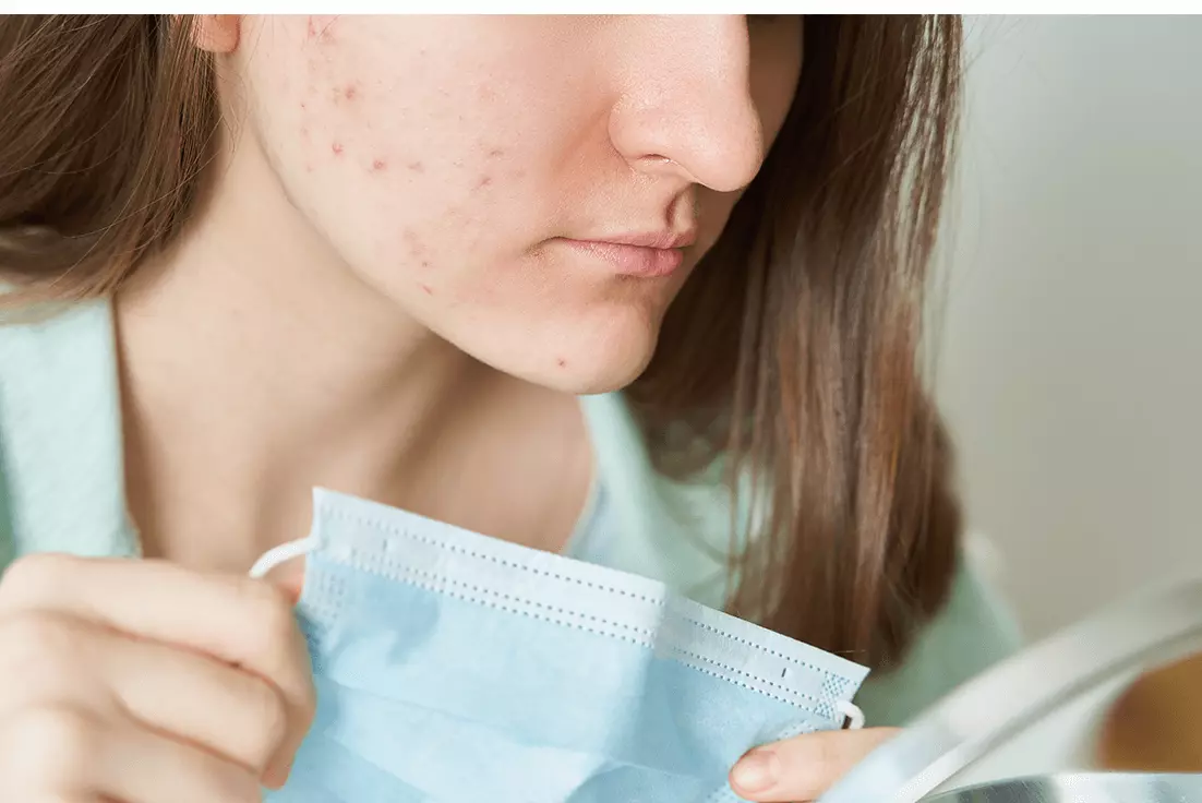 Use micellar water to prevent maskne